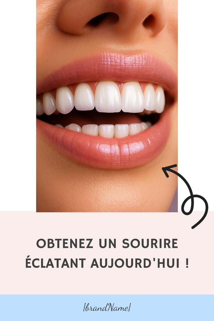 ✨ Kit de Blanchiment Dentaire LuxeSmile